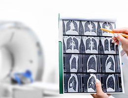 A doctor looks at images from a chest CT scan.
